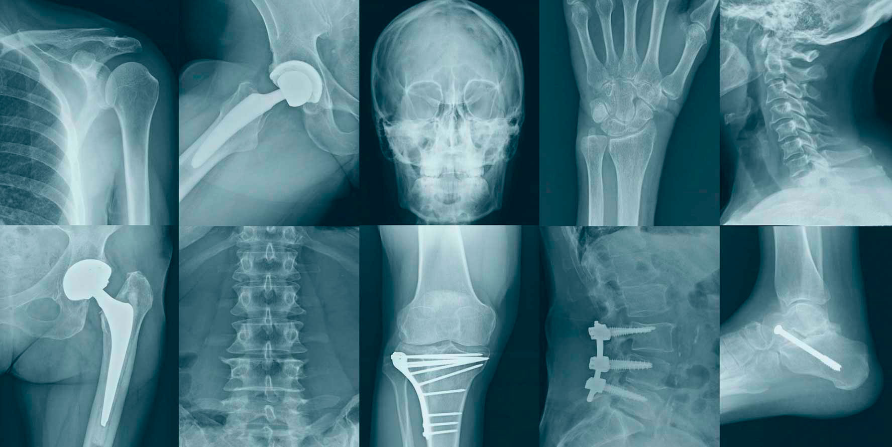 radiologia generale digitale