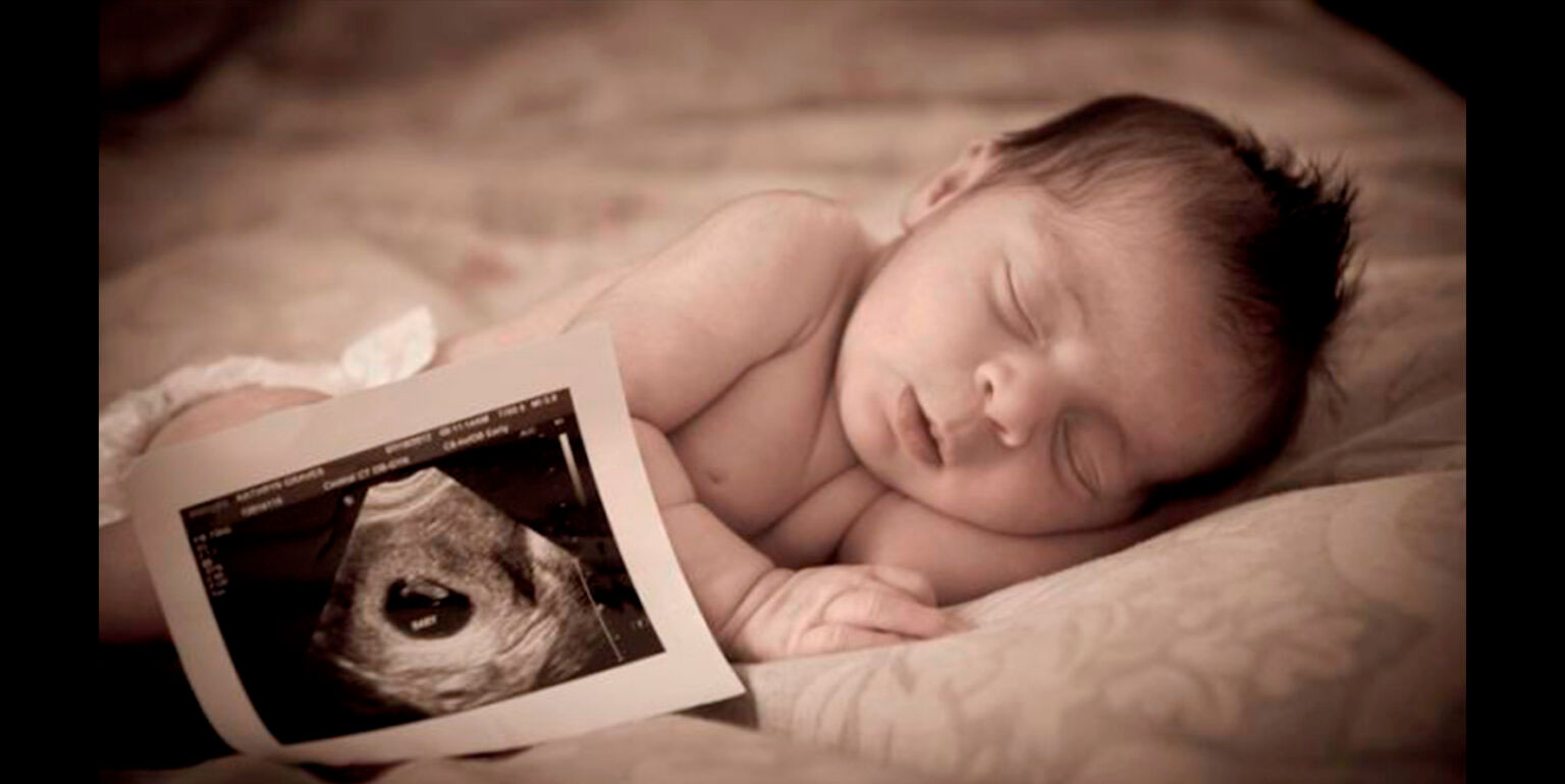 ecografie neonatali